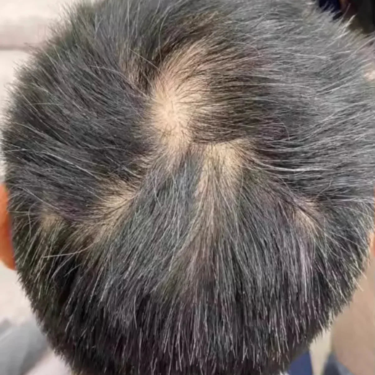 HairsActivator™ – Krem do Włosów o Natychmiastowej Gęstości